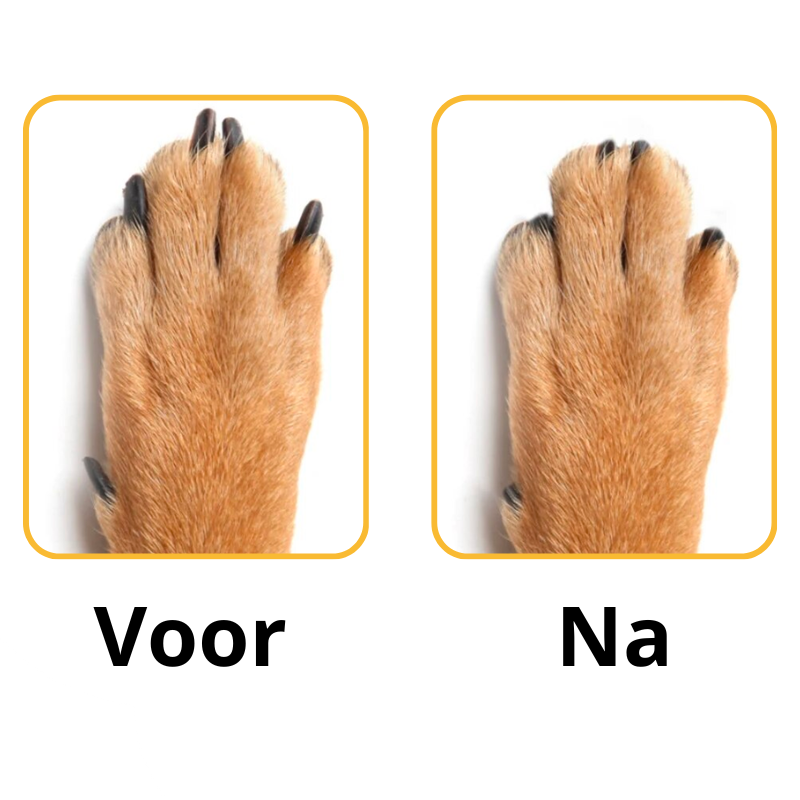 PootVijl™ | Zeg vaarwel tegen angst voor nagels knippen!